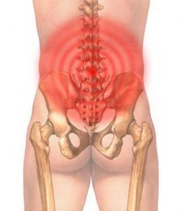 zona_di_dolore_nella_lombocruralgia