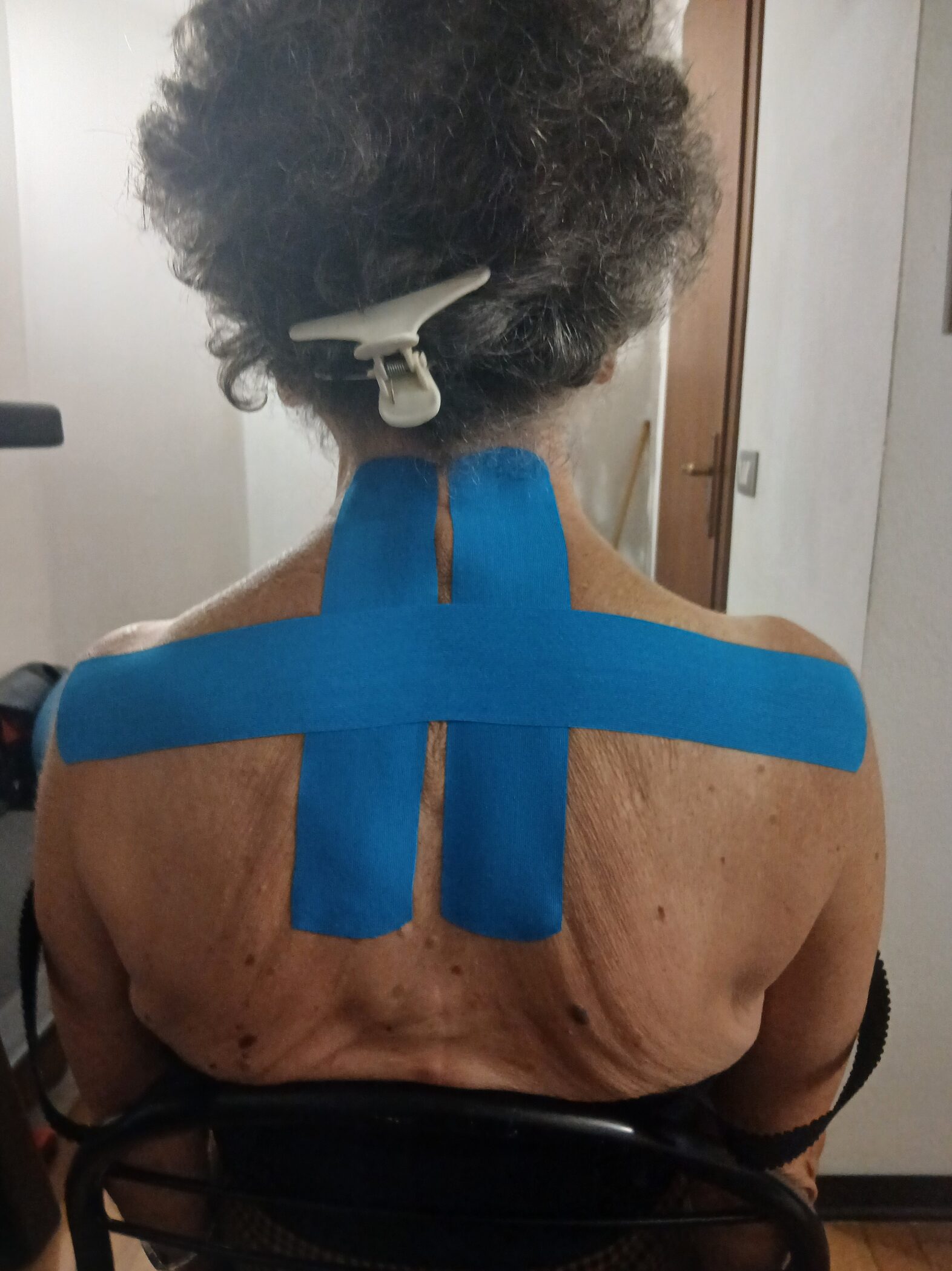 Taping kinesiologico con effetto neuromuscolare esterocettivo